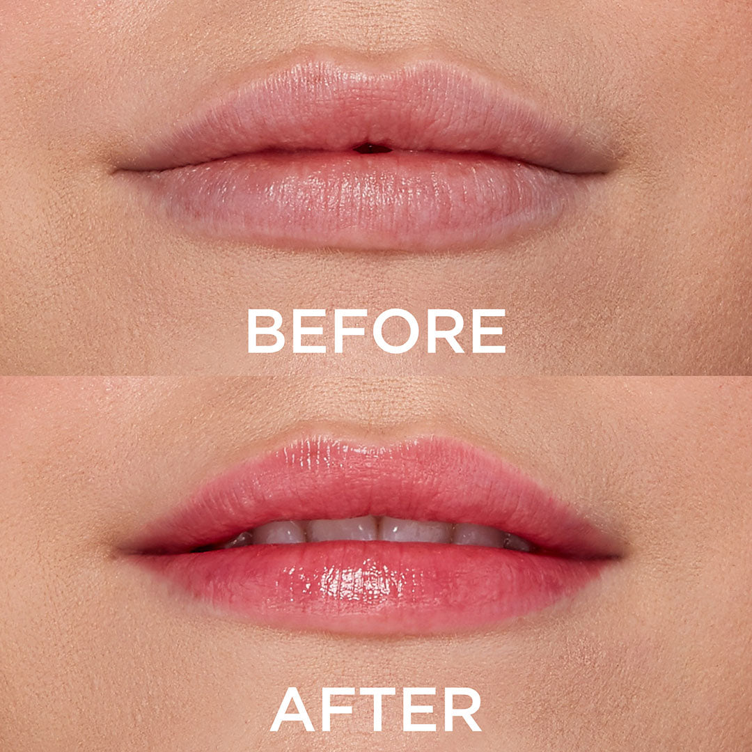 DEWY MOISTURIZING LIP BALM BEFORE AFTER